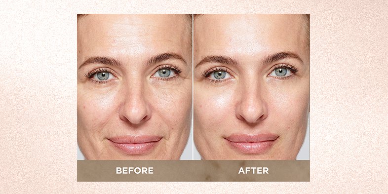 In-Article-best-anti-aging-cream_3